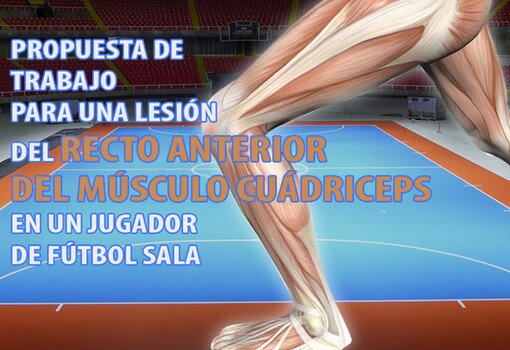 Medicina deportiva: Propuesta de trabajo para una lesión del recto anterior del músculo cuádriceps